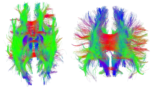 Figure 1: Dorsal (a) and Posterior (b) Views of DTI-Produced Axonal Fiber Tractography.