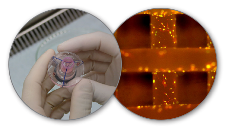 Figure 4 (right): Electrospun Hydrogel/Tissue Scaffold. Figure 5 (left): Tissue Engineered Heart Valve. 